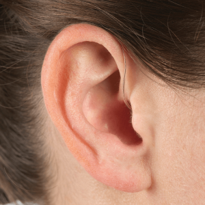 Receiver In The Ear (RITE) Hearing Aid